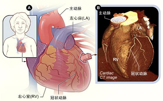 冠心病需要做哪些检查？(图2)